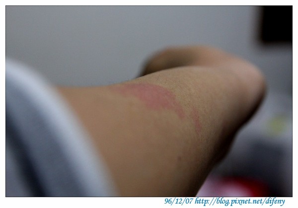 [日子的顏色]病~